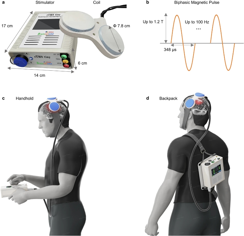 China brain-computer interface progress